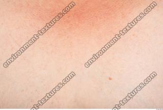 photo texture of white skin 0039